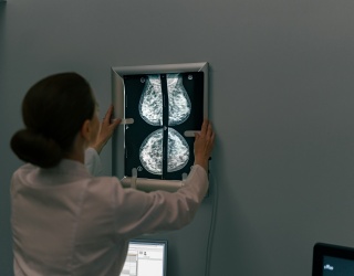 Calidar Reports First 4D Mammography Imaging System