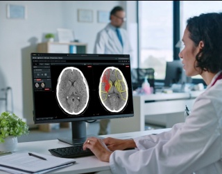 Brainomix Stroke AI Software Hailed as ῾Revolutionary,’ Helping More Patients Fully Recover