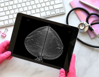Gnosis for Her Launches Mobile 3D Breast CT Care Unit