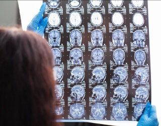 MRI Connectivity Patterns May Help Predict TBI Recovery