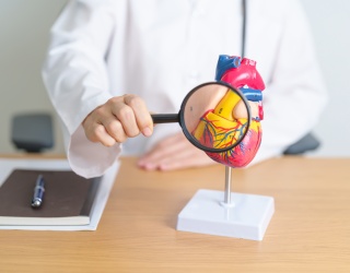 Combined OCT and MRI Improve Diagnosis of MINOCA