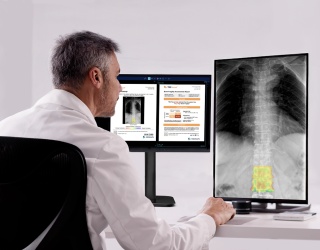 Medimaps Introduces TBS Reveal for AI X-Ray Bone Screening