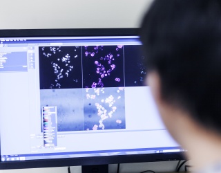 Bayer Expands Radiology Portfolio Into Diagnostic Tracers